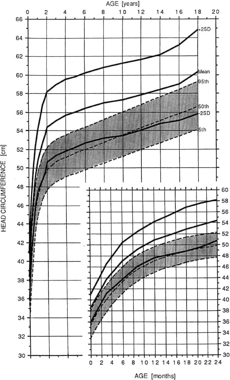Achondroplasia Height Chart